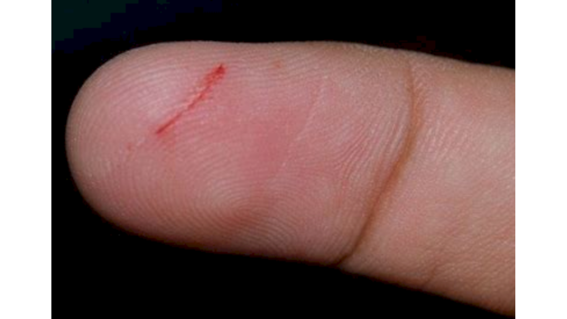 Salt, Wounds, and the Most Unkindest Cuts of All